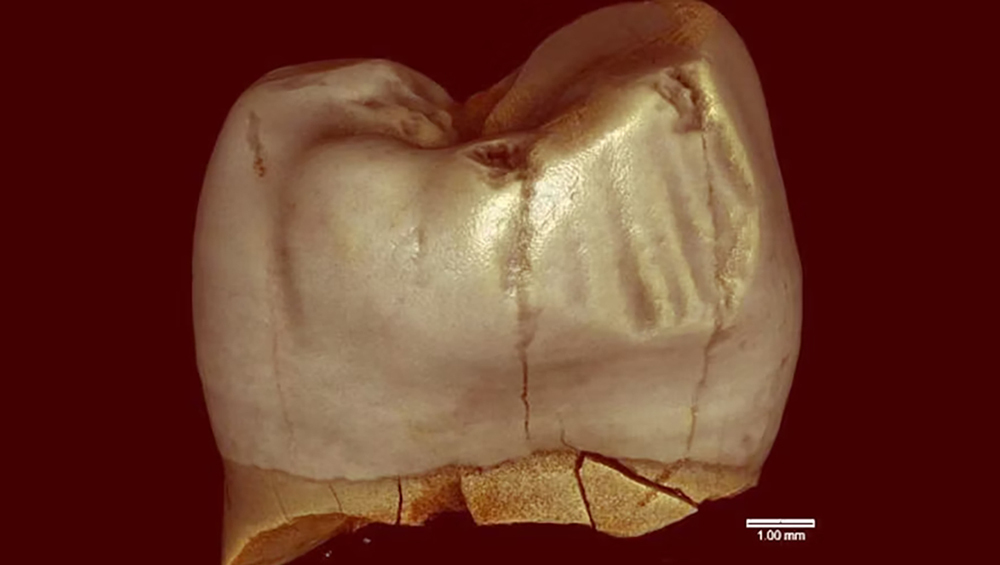 Древняя загадка зубов: ученые опровергли миф о «зубочистках» наших предков