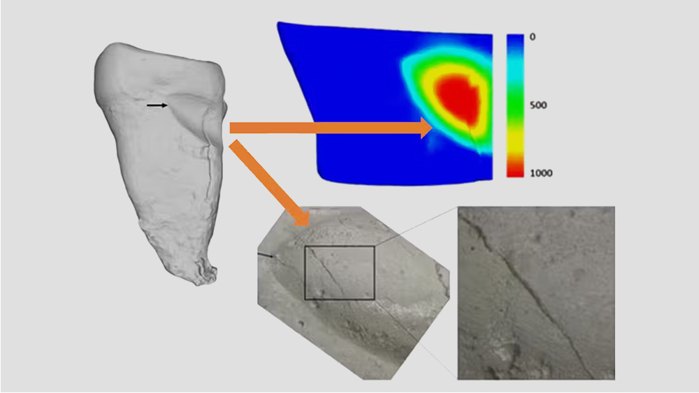 бороздки на зубах