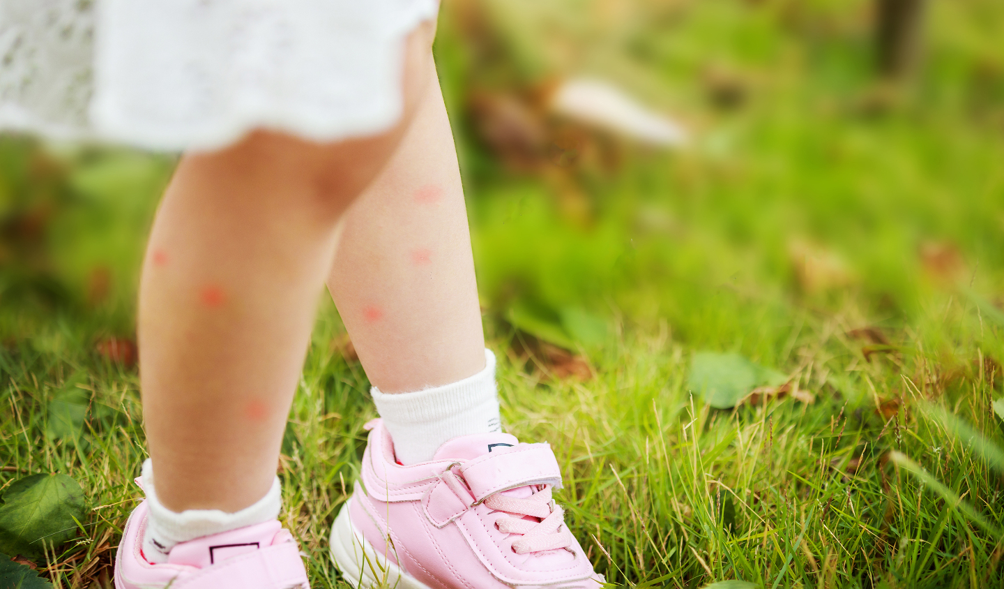 что делать при укусе