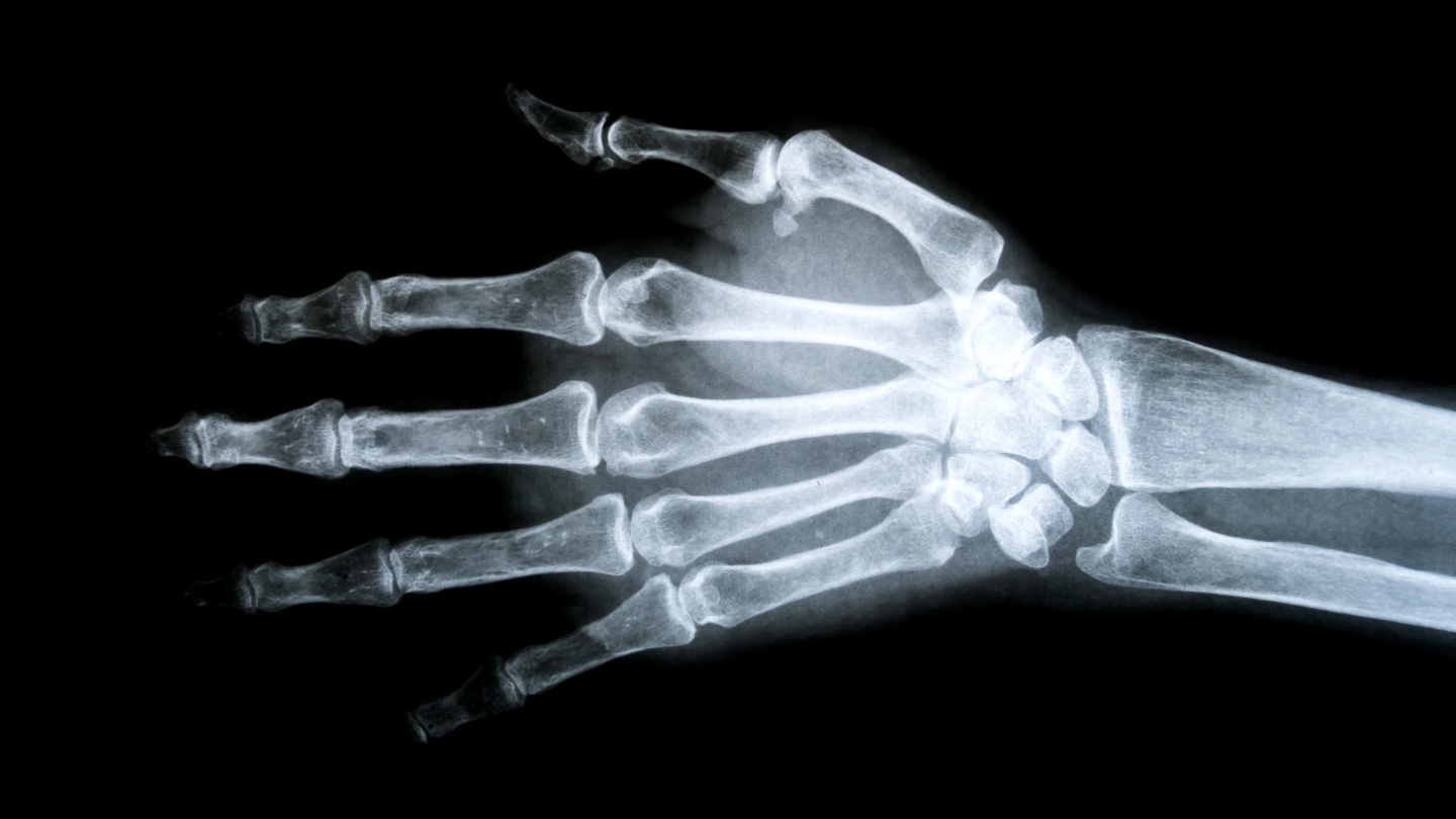 кости, человек